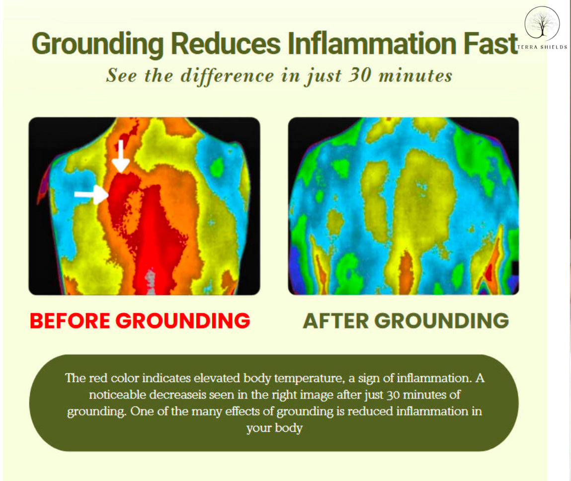 TerraShields™ Earth Grounding Mat
